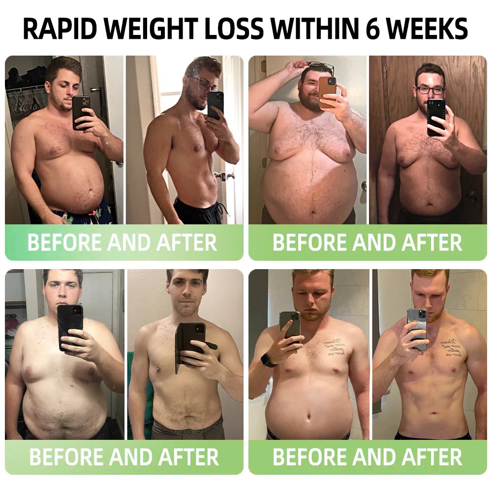 𝑷𝑬𝑨𝑹𝑳𝑴𝑶𝑶𝐍® 𝑰𝒄𝒆 𝑺𝒊𝒍𝒌 𝑰𝒐𝒏-𝑭𝒊𝒃𝒆𝒓 𝑹𝒆𝒑𝒂𝒊𝒓 𝑺𝒉𝒂𝒑𝒊𝒏𝒈 𝑺𝒉𝒐𝐫𝐭𝐬 👨‍⚕️𝐅𝐚𝐭 𝐛𝐮𝐫𝐧𝐢𝐧𝐠, 𝐬𝐤𝐢𝐧 𝐭𝐢𝐠𝐡𝐭𝐞𝐧𝐢𝐧𝐠, 𝐩𝐫𝐨𝐦𝐨𝐭𝐢𝐧𝐠 𝐜𝐢𝐫𝐜𝐮𝐥𝐚𝐭𝐢𝐨𝐧 & 𝐥𝐲𝐦𝐩𝐡𝐚𝐭𝐢𝐜 𝐝𝐫𝐚𝐢𝐧𝐚𝐠𝐞 𝐟𝐨𝐫 𝐡𝐨𝐥𝐢𝐬𝐭𝐢𝐜 𝐡𝐞𝐚𝐥𝐭𝐡