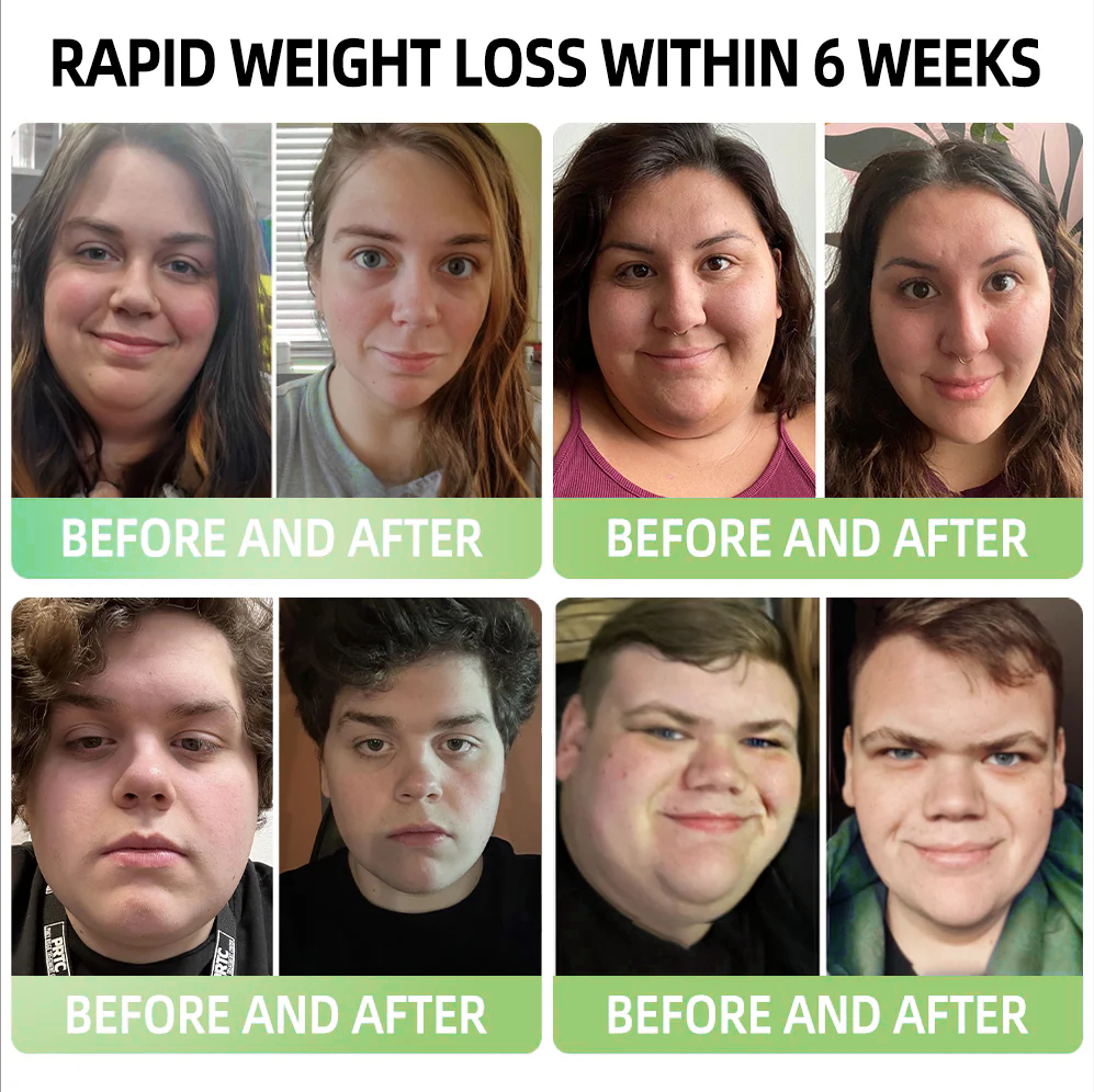 𝑷𝑬𝑨𝑹𝑳𝑴𝑶𝑶𝐍® 𝑰𝒄𝒆 𝑺𝒊𝒍𝒌 𝑰𝒐𝒏-𝑭𝒊𝒃𝒆𝒓 𝑹𝒆𝒑𝒂𝒊𝒓 𝑺𝒉𝒂𝒑𝒊𝒏𝒈 𝑺𝒉𝒐𝐫𝐭𝐬 👨‍⚕️𝐅𝐚𝐭 𝐛𝐮𝐫𝐧𝐢𝐧𝐠, 𝐬𝐤𝐢𝐧 𝐭𝐢𝐠𝐡𝐭𝐞𝐧𝐢𝐧𝐠, 𝐩𝐫𝐨𝐦𝐨𝐭𝐢𝐧𝐠 𝐜𝐢𝐫𝐜𝐮𝐥𝐚𝐭𝐢𝐨𝐧 & 𝐥𝐲𝐦𝐩𝐡𝐚𝐭𝐢𝐜 𝐝𝐫𝐚𝐢𝐧𝐚𝐠𝐞 𝐟𝐨𝐫 𝐡𝐨𝐥𝐢𝐬𝐭𝐢𝐜 𝐡𝐞𝐚𝐥𝐭𝐡