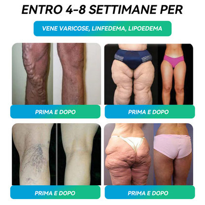 🎁 𝐇𝐇𝑽𝑩® Solo 10 confezioni rimaste! Approfitta ora del -30% di sconto esclusivo! Raccomandato dagli endocrinologi: 4–6 confezioni aiutano a mantenere il peso e prevenire l’effetto yo-yo. 📅 Ultima occasione prima della fine dell’anno, non perderla!