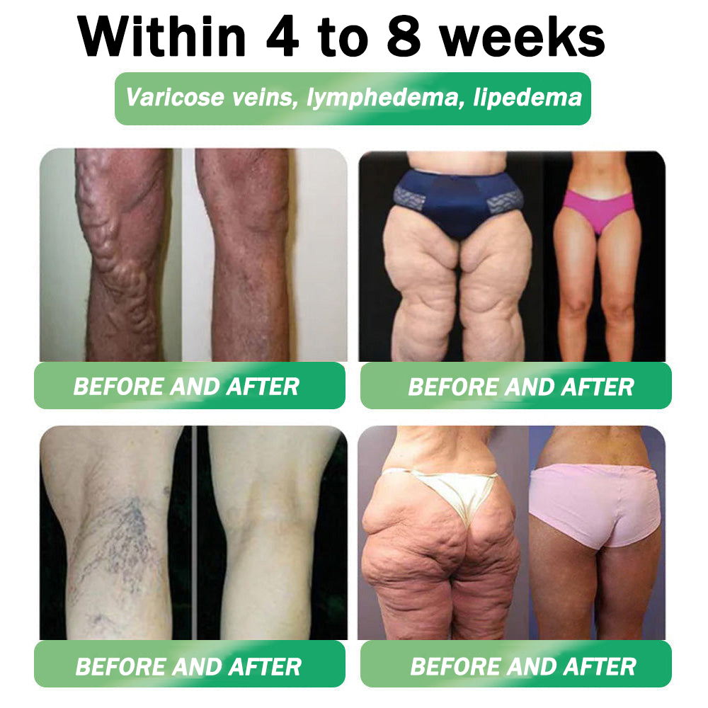 🇺🇸𝑶𝒇𝒇𝒊𝒄𝒊𝒂𝒍 𝑺𝒕𝒐𝒓𝒆  | 𝑯𝑯𝑽𝑩®🎁🎁𝐺𝐿𝑃-𝟏  𝑺𝑰𝑿 𝑰𝑵-𝑶𝑵𝑬 𝑯𝒆𝒂𝒍𝒕𝒉 𝑺𝒐𝒍𝒖𝒕𝒊𝒐𝒏 𝑶𝒓𝒂𝒍 𝑳𝒊𝒒𝒖𝒊𝒅  (𝐉𝐮𝐬𝐭 𝐨𝐧𝐜𝐞 𝐚 𝐝𝐚𝐲, 𝐯𝐢𝐬𝐢𝐛𝐥𝐞 𝐜𝐡𝐚𝐧𝐠𝐞𝐬 𝐢𝐧 𝟕 𝐝𝐚𝐲𝐬） ✅ 𝐅𝐨𝐫 𝐨𝐛𝐞𝐬𝐢𝐭𝐲, 𝐜𝐚𝐫𝐝𝐢𝐨𝐯𝐚𝐬𝐜𝐮𝐥𝐚𝐫 𝐡𝐞𝐚𝐥𝐭𝐡, 𝐝𝐢𝐚𝐛𝐞𝐭𝐞𝐬, 𝐬𝐥𝐞𝐞𝐩 𝐚𝐩𝐧𝐞𝐚, 𝐣𝐨𝐢𝐧𝐭 𝐢𝐬𝐬𝐮𝐞𝐬, 𝐚𝐧𝐝 𝐦𝐨𝐫𝐞