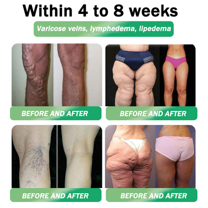 🇺🇸𝑶𝒇𝒇𝒊𝒄𝒊𝒂𝒍 𝑺𝒕𝒐𝒓𝒆  | 𝑯𝑯𝑽𝑩®🎁🎁𝐺𝐿𝑃-𝟏  𝑺𝑰𝑿 𝑰𝑵-𝑶𝑵𝑬 𝑯𝒆𝒂𝒍𝒕𝒉 𝑺𝒐𝒍𝒖𝒕𝒊𝒐𝒏 𝑶𝒓𝒂𝒍 𝑳𝒊𝒒𝒖𝒊𝒅  (𝐉𝐮𝐬𝐭 𝐨𝐧𝐜𝐞 𝐚 𝐝𝐚𝐲, 𝐯𝐢𝐬𝐢𝐛𝐥𝐞 𝐜𝐡𝐚𝐧𝐠𝐞𝐬 𝐢𝐧 𝟕 𝐝𝐚𝐲𝐬） ✅ 𝐅𝐨𝐫 𝐨𝐛𝐞𝐬𝐢𝐭𝐲, 𝐜𝐚𝐫𝐝𝐢𝐨𝐯𝐚𝐬𝐜𝐮𝐥𝐚𝐫 𝐡𝐞𝐚𝐥𝐭𝐡, 𝐝𝐢𝐚𝐛𝐞𝐭𝐞𝐬, 𝐬𝐥𝐞𝐞𝐩 𝐚𝐩𝐧𝐞𝐚, 𝐣𝐨𝐢𝐧𝐭 𝐢𝐬𝐬𝐮𝐞𝐬, 𝐚𝐧𝐝 𝐦𝐨𝐫𝐞